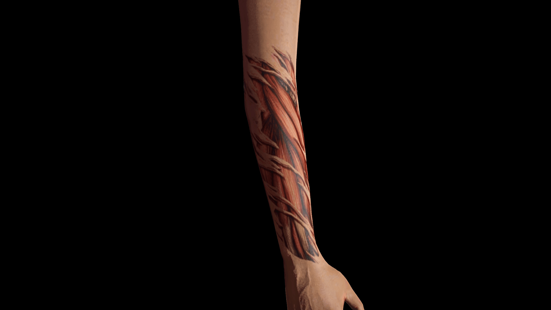Déchirure musculaire